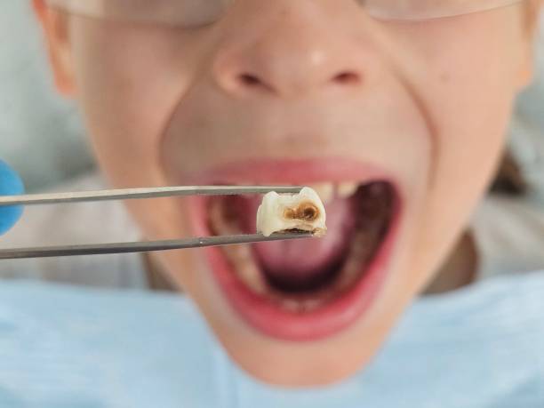 Best Tooth Infection Emergency Dentist  in Chicago Ridge, IL