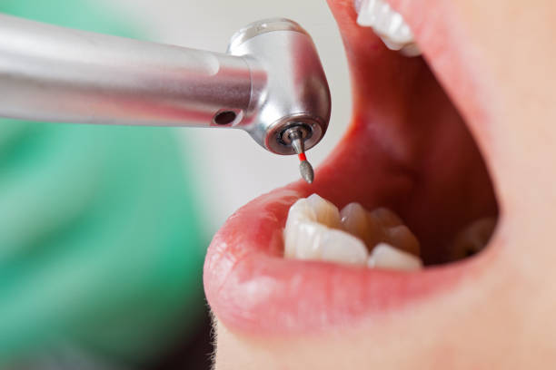 Best Cracked Tooth Emergency Dentist  in Chicago Ridge, IL
